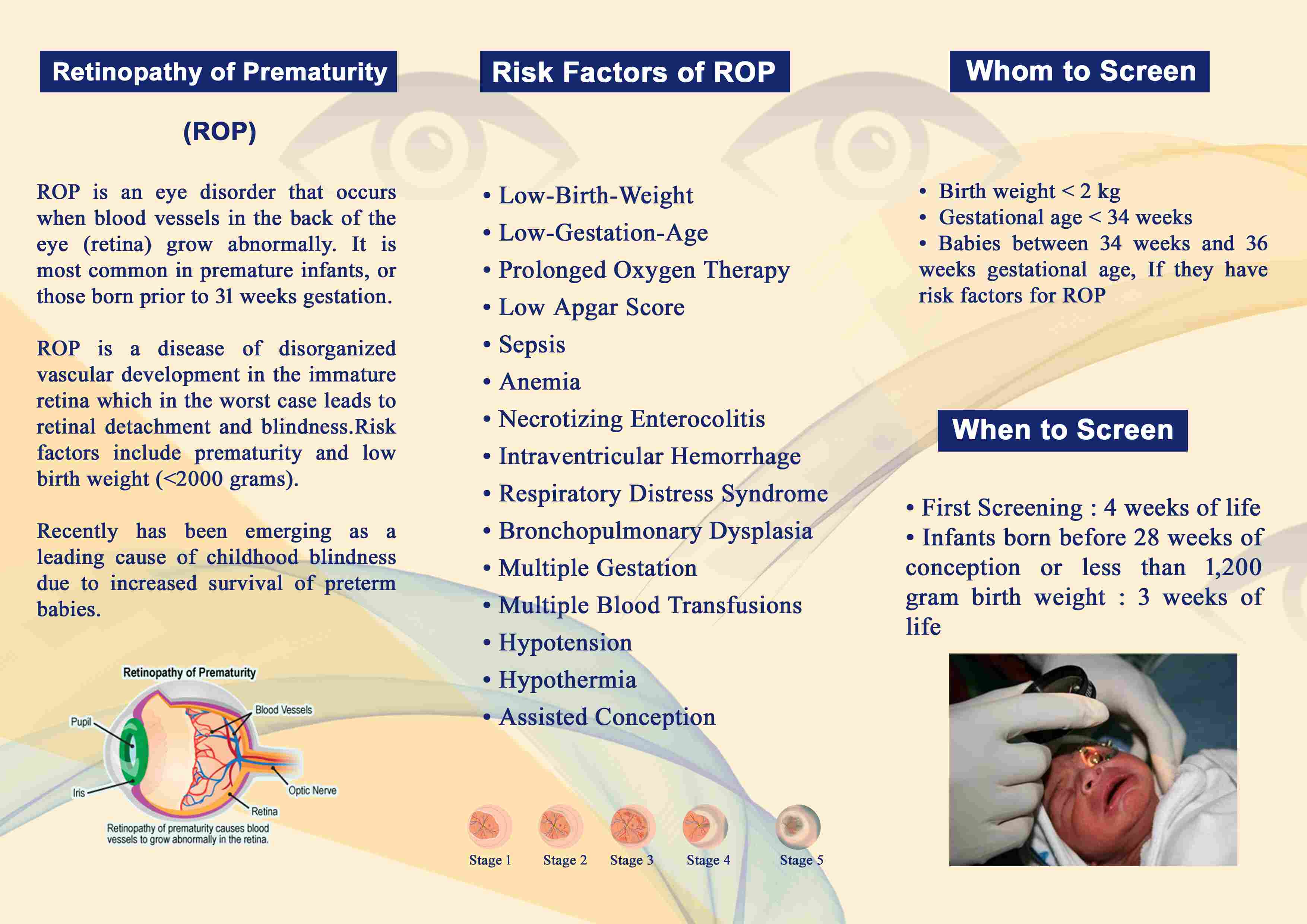 retinopathy of prematurity